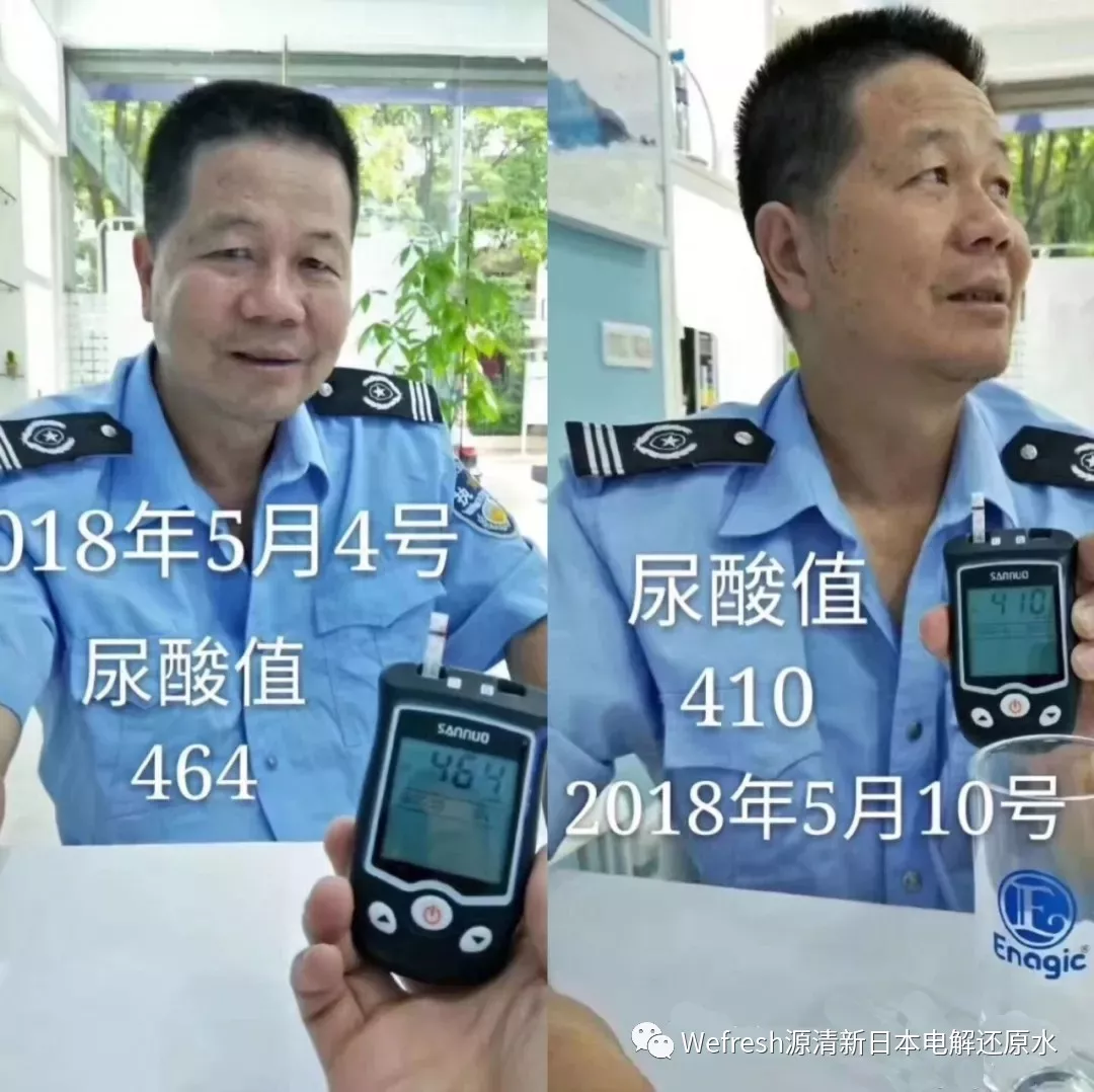 还原水让“尿酸高”，痛风不治而愈