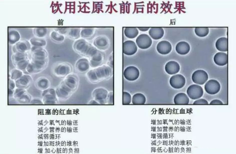 水管堵了可以通,血管堵了怎么办?!-还原水