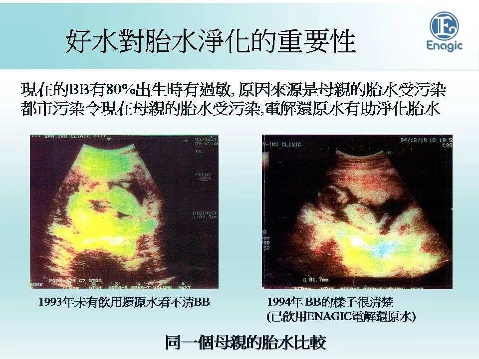 喝还原水有助于净化羊水